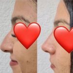 Green Peel Bodycareaesthetic Lippenpigmentierung Pigmentfleckenentfernung Microdermabrasion Microneedling Aquafacial Laserhaarentfernung Carbon Laser Permanent Make up Entfernung ( Augenbrauen ) Zahnbleaching Kräuterschälkur Bb Glow Radiofrequenz- Needling hanau Kosmetikstudio Beuty Salon