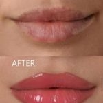 Green Peel Bodycareaesthetic Lippenpigmentierung Pigmentfleckenentfernung Microdermabrasion Microneedling Aquafacial Laserhaarentfernung Carbon Laser Permanent Make up Entfernung ( Augenbrauen ) Zahnbleaching Kräuterschälkur Bb Glow Radiofrequenz- Needling hanau Kosmetikstudio Beuty Salon