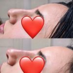 Green Peel Bodycareaesthetic Lippenpigmentierung Pigmentfleckenentfernung Microdermabrasion Microneedling Aquafacial Laserhaarentfernung Carbon Laser Permanent Make up Entfernung ( Augenbrauen ) Zahnbleaching Kräuterschälkur Bb Glow Radiofrequenz- Needling hanau Kosmetikstudio Beuty Salon